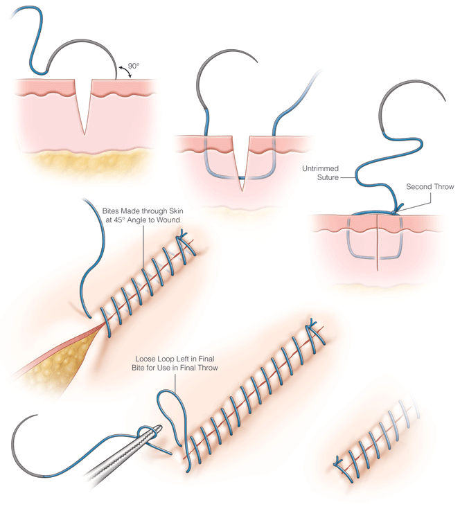 suture - DriverLayer Search Engine