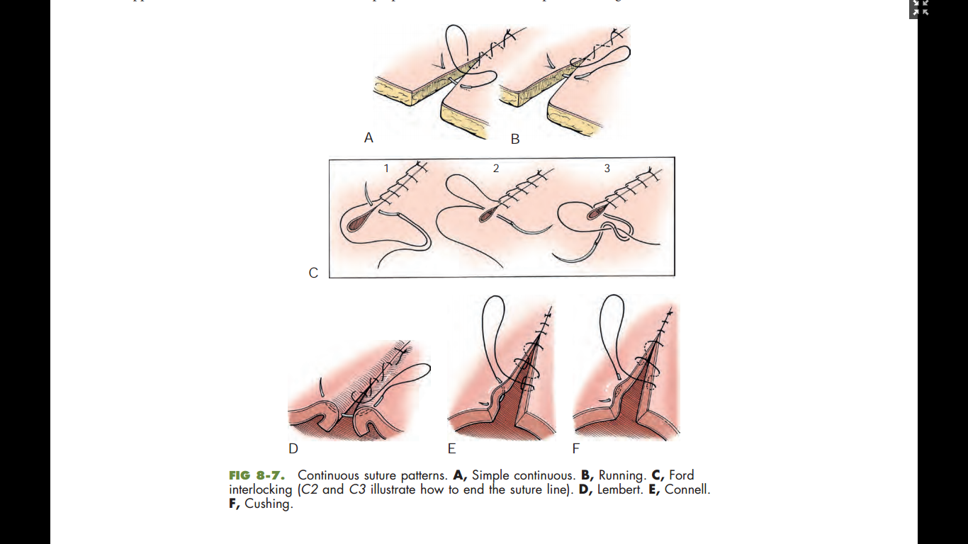 Suture Continuous Patterns Surgery Knot Ihmc Square.