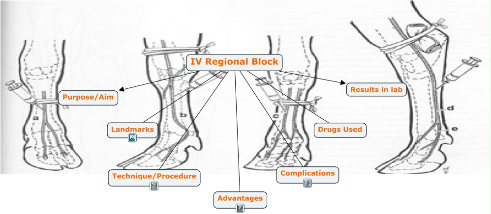 IV Regional Anaesthesia