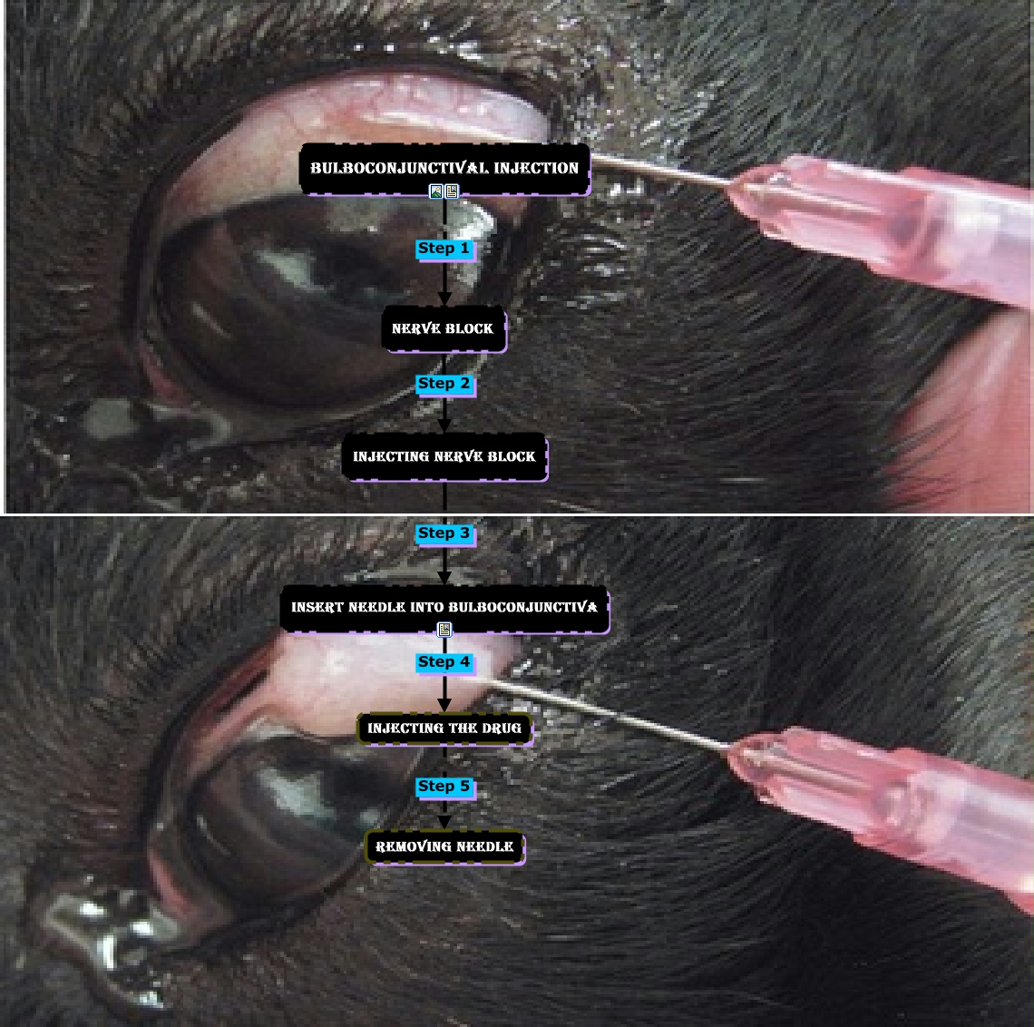 Bulboconjunctival Injection