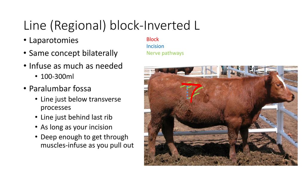 Intraoperative procedure